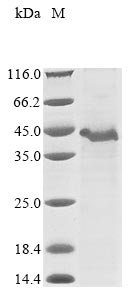 Human A disintegrin and metalloproteinase with thrombospondin motifs 9 (ADAMTS9), partial Recombinant Protein, Homo sapiens (Human), E.coli, N-terminal 10xHis-tagged and C-terminal Myc-tagged, 46.8 kDa, purity >≥ 85% as determined by SDS-PAGE.