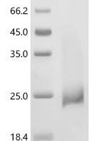 Notechis scutatus scutatus Acidic phospholipase A2 HTe Recombinant Protein - BioCrest Sci