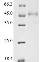 Mouse Calreticulin (Calr) Recombinant Protein - BioCrest Sci