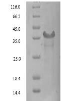 Human Signal-regulatory protein gamma (SIRPG), partial Recombinant Protein, N-His, aa 29–360, Yeast - BioCrest Sci