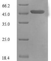 Human Mitochondrial brown fat uncoupling protein 1 (UCP1) Recombinant Protein, N-His-SUMO - BioCrest Sci