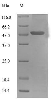 Human Mitochondrial brown fat uncoupling protein 1 (UCP1) Recombinant Protein, N-His-SUMO, Homo sapiens (Human), E.coli, N-terminal 6xHis-SUMO-tagged, 48.9 kDa, purity >≥ 90% as determined by SDS-PAGE.