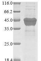 Human herpesvirus 1 Thymidine kinase (TK) Recombinant Protein, N-10His/C-Myc - BioCrest Sci
