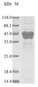Human herpesvirus 1 Thymidine kinase (TK) Recombinant Protein, N-10His/C-Myc, Human herpesvirus 1 (strain 17) (HHV-1) (Human herpes simplex virus 1), Yeast, N-terminal 10xHis-tagged and C-terminal Myc-tagged, 44.9 kDa, purity >≥ 85% as determined by SDS-PAGE.