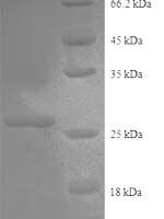 Human Collagen alpha-2 (IV) chain (COL4A2), partial Recombinant Protein, N-His - BioCrest Sci