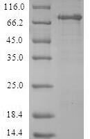 Human Aminoacylase-1 (ACY1) Recombinant Protein - BioCrest Sci