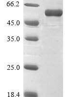 Rat E3 ubiquitin-protein ligase parkin (Park2) Recombinant Protein - BioCrest Sci