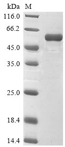 Rat E3 ubiquitin-protein ligase parkin (Park2) Recombinant Protein, Rattus norvegicus (Rat), E.coli, N-terminal 10xHis-tagged and C-terminal Myc-tagged, 56.7 kDa, purity >≥ 90% as determined by SDS-PAGE.