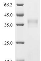 Human Butyrophilin-like protein 9 (BTNL9), partial Recombinant Protein - BioCrest Sci