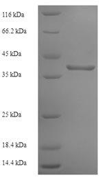 Human Interferon alpha/beta receptor 2 (IFNAR2), partial Recombinant Protein, Homo sapiens (Human), E.coli, N-terminal 6xHis-SUMO-tagged, 40.8 kDa, purity >≥ 90% as determined by SDS-PAGE.