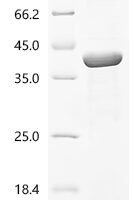 Epstein-Barr virus Envelope glycoprotein L (gL) Recombinant Protein, N-His-GST - BioCrest Sci