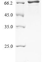 Mouse Vitronectin (Vtn) Recombinant Protein - BioCrest Sci