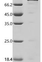 Human ITGAV&ITGB3 Heterodimer Protein, Biotinylated Recombinant Protein - BioCrest Sci
