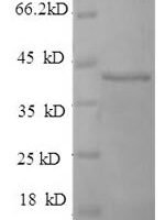 Human Selenoprotein P (SELENOP) (U59S,U300S,U318S,U330S,U345S,U352S,U367S,U369S,U376S,U378S) Recombinant Protein - BioCrest Sci