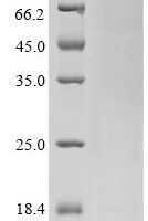 Avian infectious bronchitis virus Non-structural protein 3b (3b) Recombinant Protein, C-His, aa 1–64, strain Beaudette - BioCrest Sci