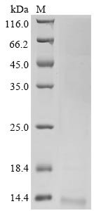 Avian infectious bronchitis virus Non-structural protein 3b (3b) Recombinant Protein, C-His, aa 1–64, strain Beaudette, Avian infectious bronchitis virus (strain Beaudette) (IBV), Yeast, C-terminal 6xHis-tagged, 8.9 kDa, purity >≥ 90% as determined by SDS-PAGE.