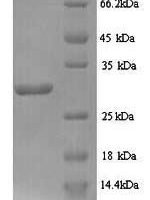 Bacillus subtilis L-cystine-binding protein tcyA (tcyA) Recombinant Protein, N-His - BioCrest Sci