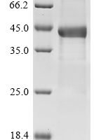 Human Complement factor H-related protein 1 (CFHR1), partial Recombinant Protein - BioCrest Sci