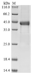 Human Complement factor H-related protein 1 (CFHR1), partial Recombinant Protein, Homo sapiens (Human), E.coli, N-terminal 10xHis-GST-tagged and C-terminal Myc-tagged, 45.2 kDa, purity >≥ 85% as determined by SDS-PAGE.