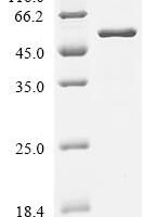 Escherichia coli Peptide release factor 2 (prfB) Recombinant Protein - BioCrest Sci