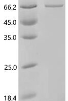 Rat Phosphatidylinositol 4,5-bisphosphate 3-kinase catalytic subunit alpha isoform (Pik3ca), partial Recombinant Protein - BioCrest Sci