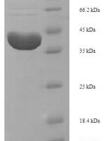 Trichosanthes kirilowii Ribosome-inactivating protein alpha-trichosanthin Recombinant Protein, N-His-SUMO - BioCrest Sci