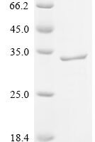 Human Pulmonary surfactant-associated protein A1 (SFTPA1) Recombinant Protein, C-hFc1 - BioCrest Sci