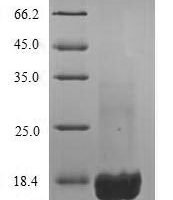 Mouse Complement receptor type 2 (Cr2), partial Recombinant Protein, N-His, aa 12–140 - BioCrest Sci