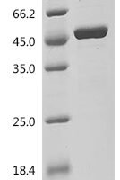 Human DNA polymerase beta (POLB) Recombinant Protein, C-His - BioCrest Sci