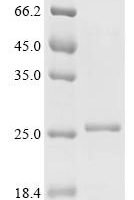 Woodchuck hepatitis B virus Protein X (X) Recombinant Protein, C-His - BioCrest Sci