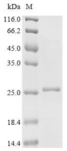 Woodchuck hepatitis B virus Protein X (X) Recombinant Protein, C-His, Woodchuck hepatitis B virus (isolate 8) (WHV), E.coli, C-terminal 6xHis-tagged, 21.3 kDa, purity >≥ 85% as determined by SDS-PAGE.