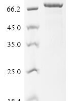 Human Sphingomyelin phosphodiesterase (SMPD1) Recombinant Protein, N-His-SUMO - BioCrest Sci