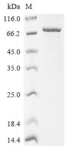 Human Sphingomyelin phosphodiesterase (SMPD1) Recombinant Protein, N-His-SUMO, Homo sapiens (Human), E.coli, N-terminal 6xHis-SUMO-tagged, 78.2 kDa, purity >≥ 90% as determined by SDS-PAGE.