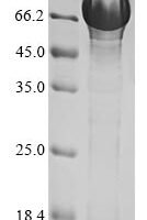 Human Ubiquilin-1 (UBQLN1) Recombinant Protein - BioCrest Sci