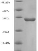 Bovine T-cell surface glycoprotein CD8 alpha chain (CD8A), partial Recombinant Protein, N-His-SUMO - BioCrest Sci