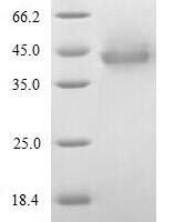 Human Inter-alpha-trypsin inhibitor heavy chain H4 (ITIH4), partial Recombinant Protein - BioCrest Sci