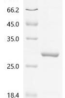 Human Leucine-rich PPR motif-containing protein, mitochondrial (LRPPRC), partial Recombinant Protein - BioCrest Sci