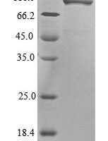 Severe acute respiratory syndrome coronavirus 2 Nucleoprotein (N),Biotinylated Recombinant Protein - BioCrest Sci