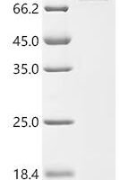 Macaca fascicularis Activin beta-C chain, partial Recombinant Protein - BioCrest Sci