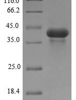 Meleagris gallopavo Acrosin (ACR) Recombinant Protein, N-10His/C-Myc - BioCrest Sci