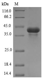 Meleagris gallopavo Acrosin (ACR) Recombinant Protein, N-10His/C-Myc, Meleagris gallopavo (Common turkey), E.coli, N-terminal 10xHis-tagged and C-terminal Myc-tagged, 43.1 kDa, purity >≥ 85% as determined by SDS-PAGE.