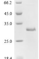 Human Interleukin-4 receptor subunit alpha (IL4R), partial Recombinant Protein, C-His - BioCrest Sci