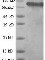 Human Succinate dehydrogenase [ubiquinone] flavoprotein subunit, mitochondrial (SDHA), partial Recombinant Protein, N-His-SUMO - BioCrest Sci