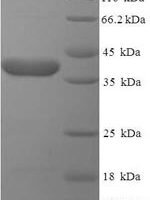Human Receptor-binding cancer antigen expressed on SiSo cells (EBAG9), partial Recombinant Protein - BioCrest Sci