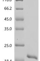 Human MAP kinase-activating death domain protein (MADD), partial Recombinant Protein - BioCrest Sci