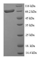 Human Rho GTPase-activating protein 19 (ARHGAP19) Recombinant Protein - BioCrest Sci