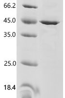 Human Anoctamin-5 (ANO5), partial Recombinant Protein - BioCrest Sci