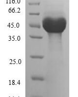 Human ADP-ribosylation factor-like protein 6 (ARL6) Recombinant Protein - BioCrest Sci