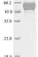 Arabidopsis thaliana UDP-glycosyltransferase 88A1 (UGT88A1) Recombinant Protein, N-10His/C-Myc, aa 1–462, E.coli - BioCrest Sci