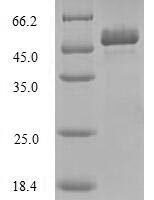 Human Toll/interleukin-1 receptor domain-containing adapter protein (TIRAP) Recombinant Protein - BioCrest Sci